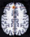 fMRI scan photo